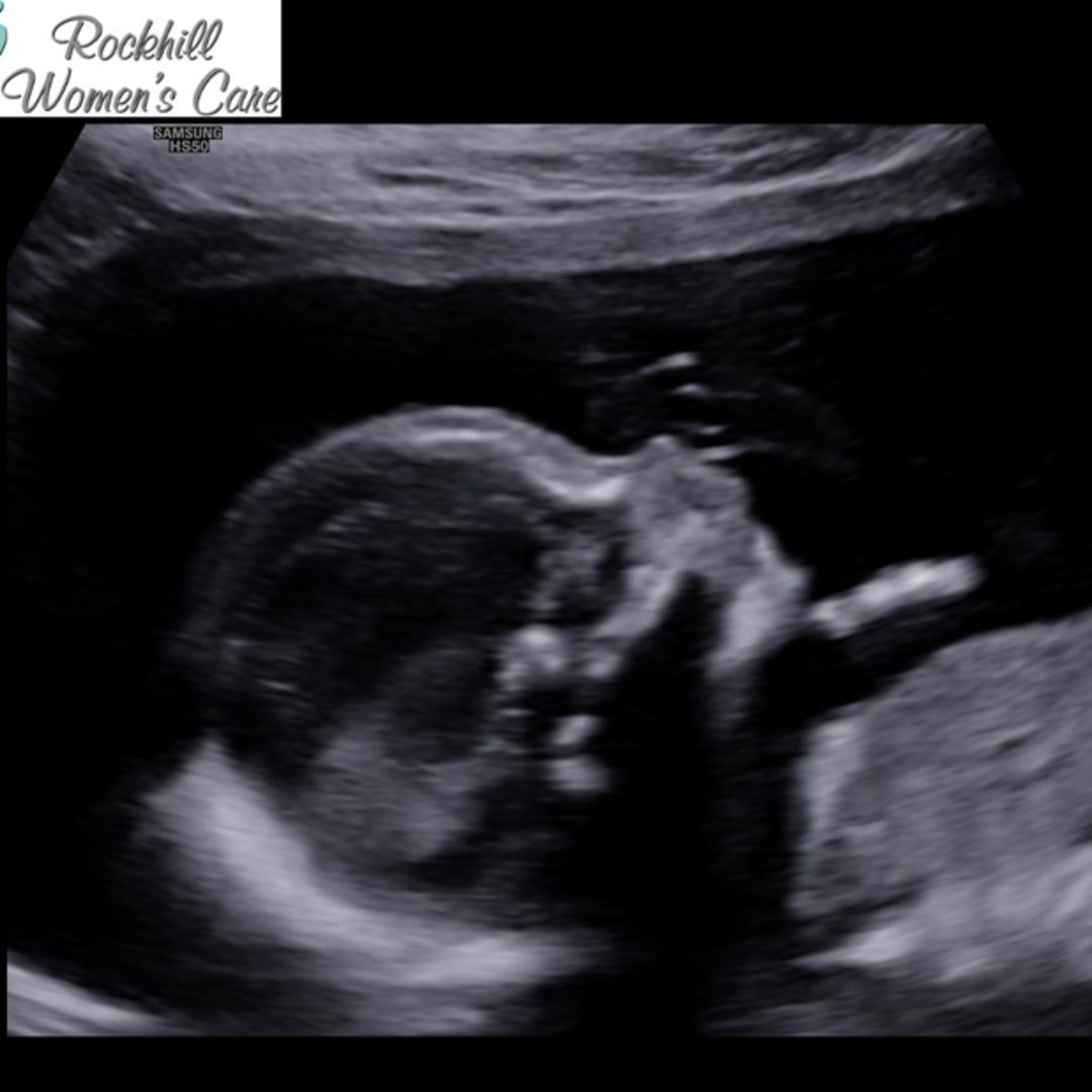 Photo shared by Kelli for their Babylist baby registry.