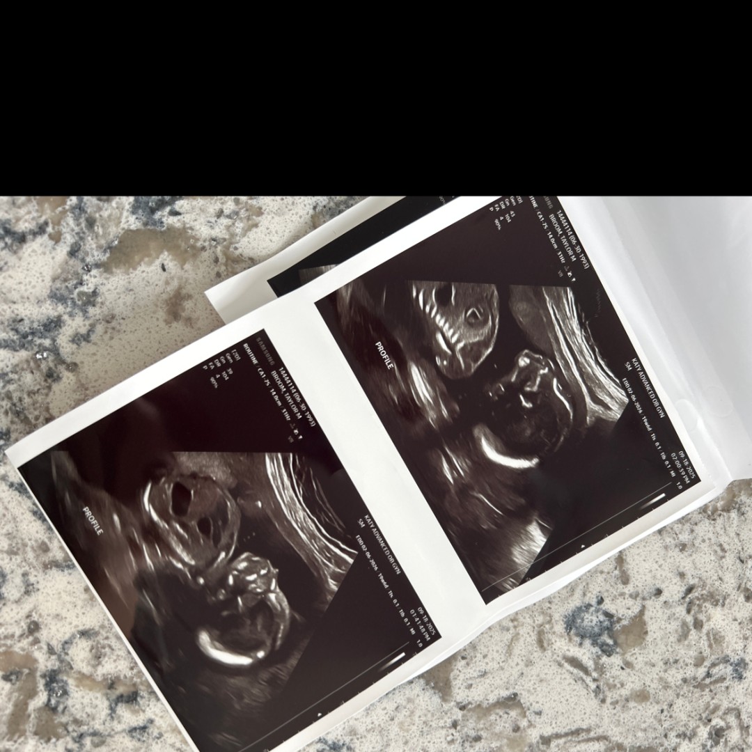 Photo shared by Taylor for their Babylist baby registry.