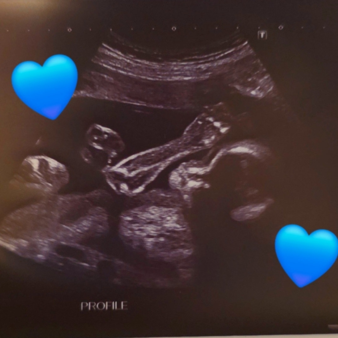 Photo shared by Kyra for their Babylist baby registry.