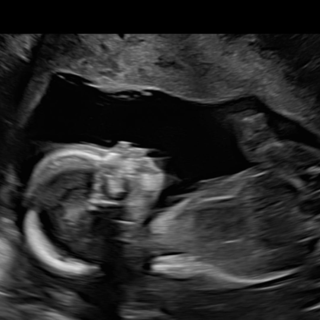 Photo shared by Anneliese for their Babylist baby registry.