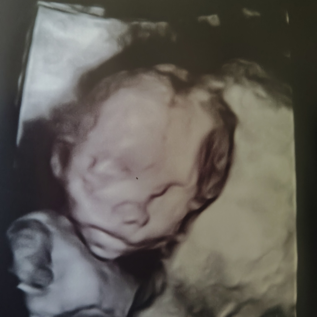 Photo shared by Billiejean for their Babylist baby registry.