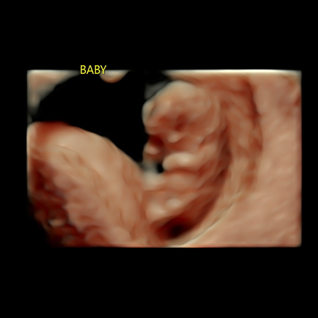 Photo shared by Chloe for their Babylist baby registry.