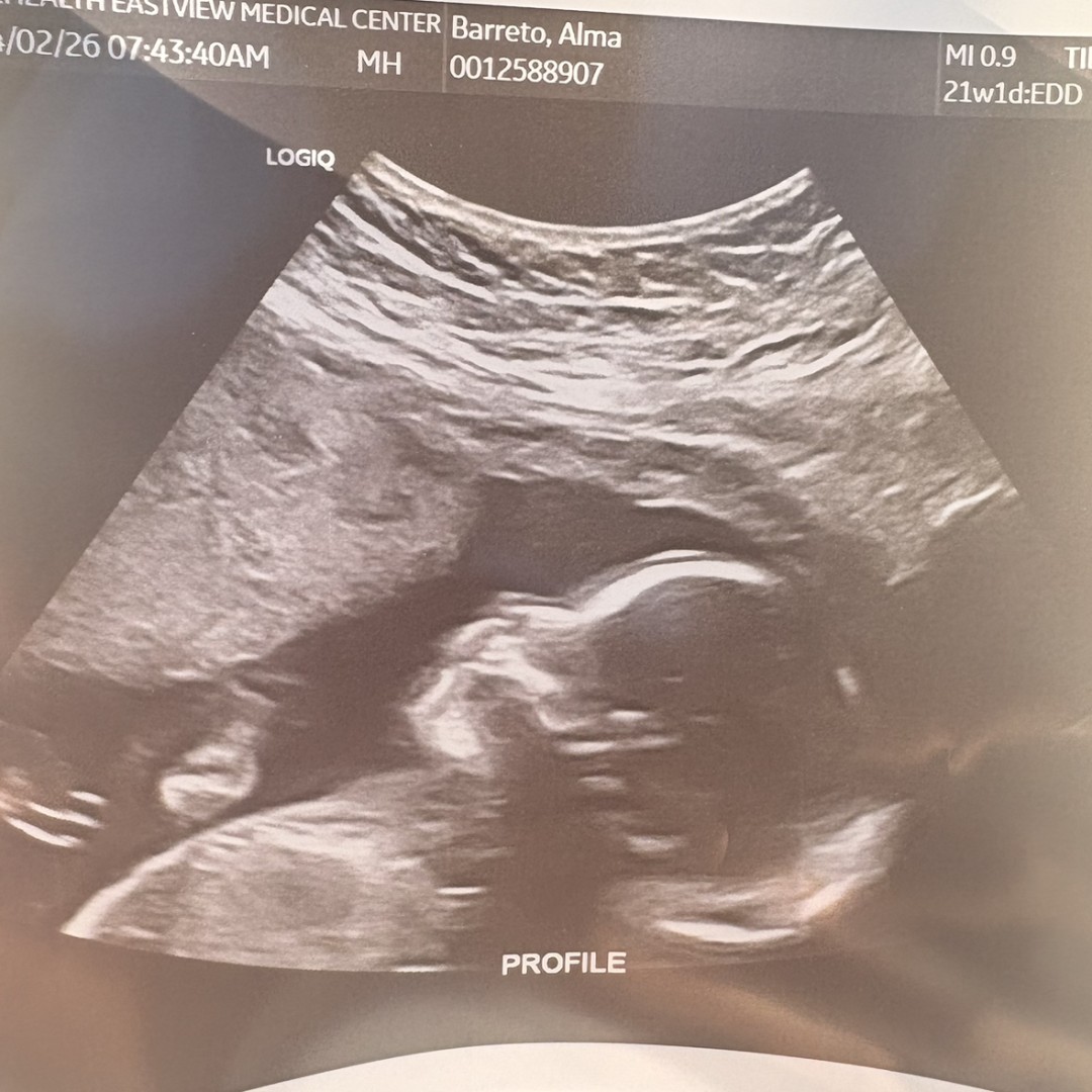 Photo shared by Alma for their Babylist baby registry.