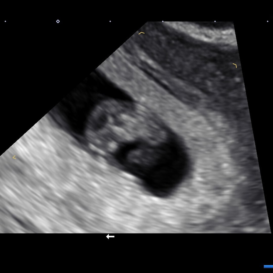 Photo shared by Ashley for their Babylist baby registry.