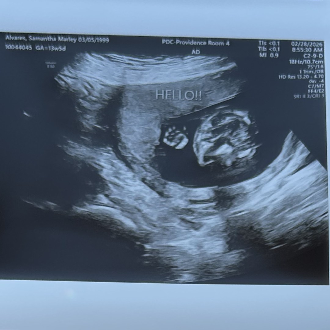 Photo shared by Samantha for their Babylist baby registry.