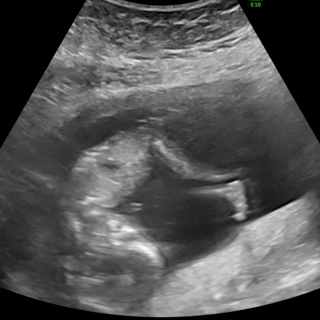 Photo shared by McKaida for their Babylist baby registry.