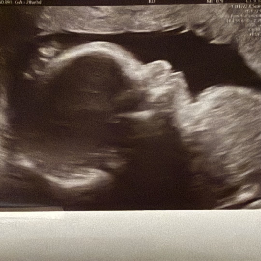 Photo shared by Enjolic for their Babylist baby registry.