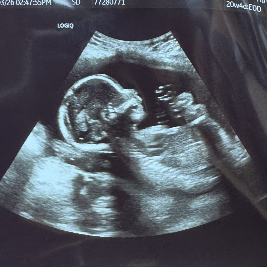 Photo shared by Holly for their Babylist baby registry.