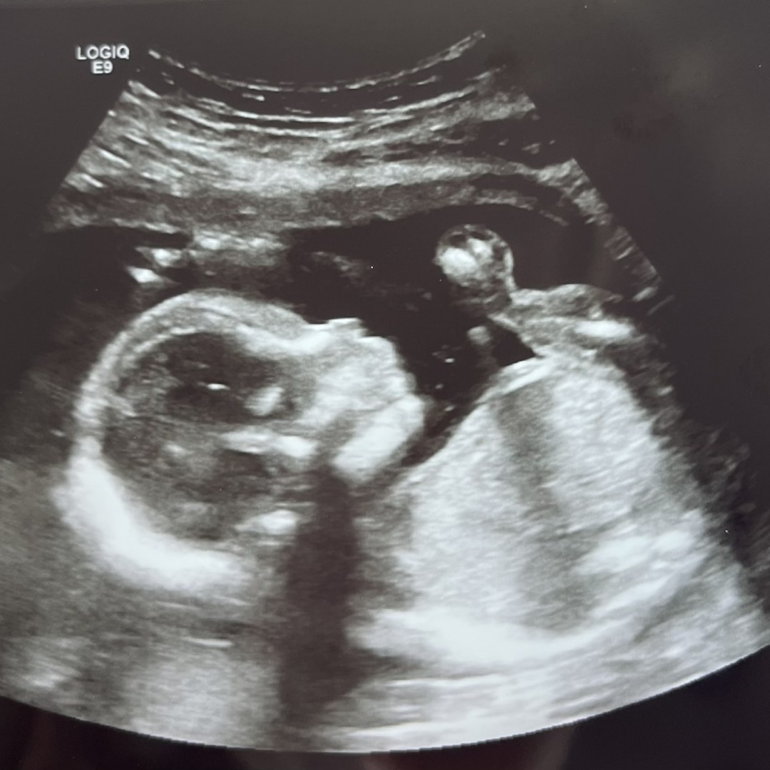 Photo shared by Crysten for their Babylist baby registry.