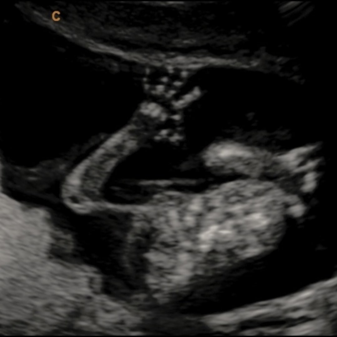 Photo shared by Sage for their Babylist baby registry.