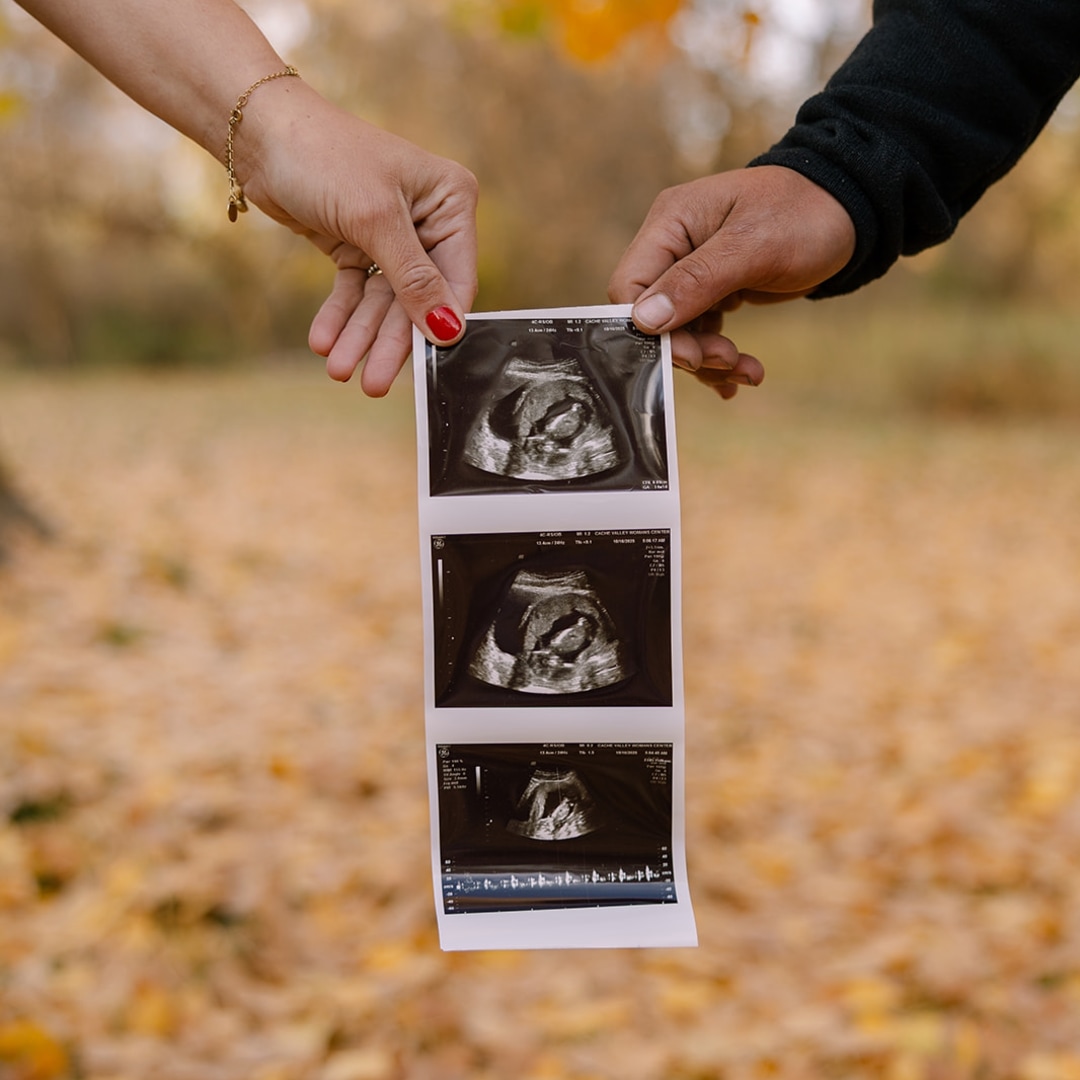 Photo shared by Mckenzie for their Babylist baby registry.