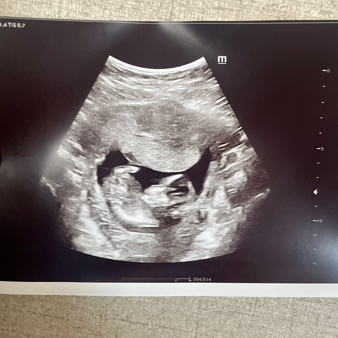 Photo shared by Berenice for their Babylist baby registry.