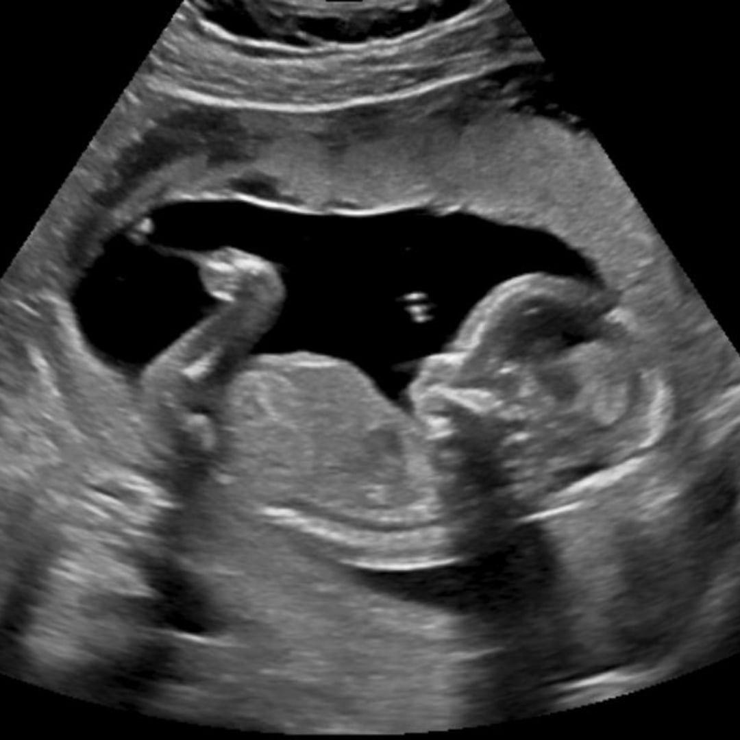 Photo shared by Sydney for their Babylist baby registry.