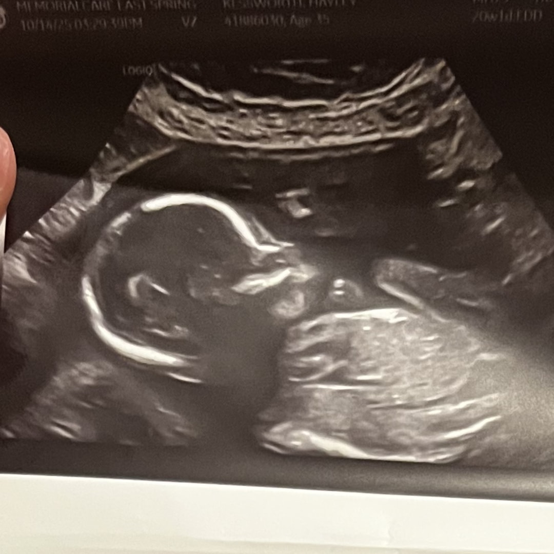 Photo shared by Hayley for their Babylist baby registry.