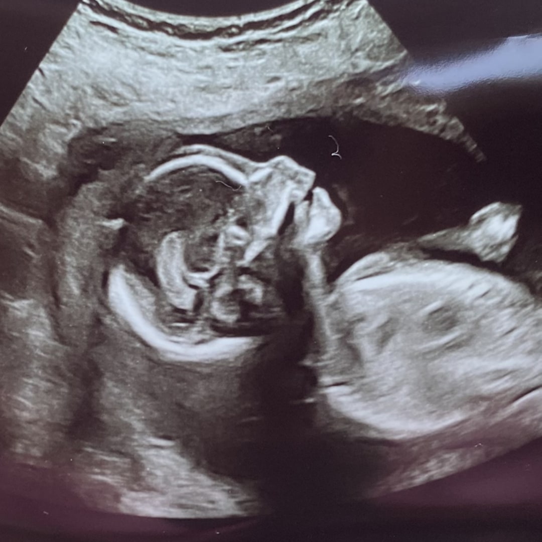 Photo shared by Elena for their Babylist baby registry.