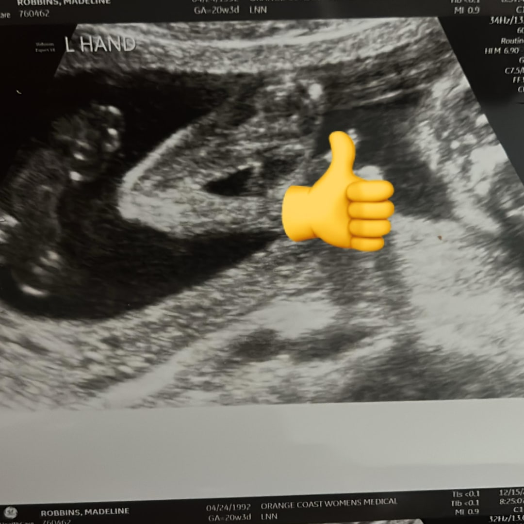 Photo shared by Madeline for their Babylist baby registry.