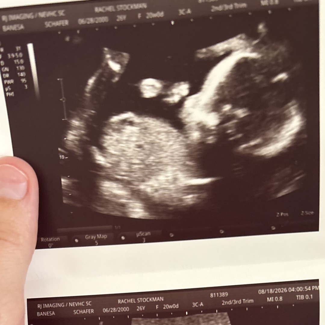 Photo shared by Rachel for their Babylist baby registry.