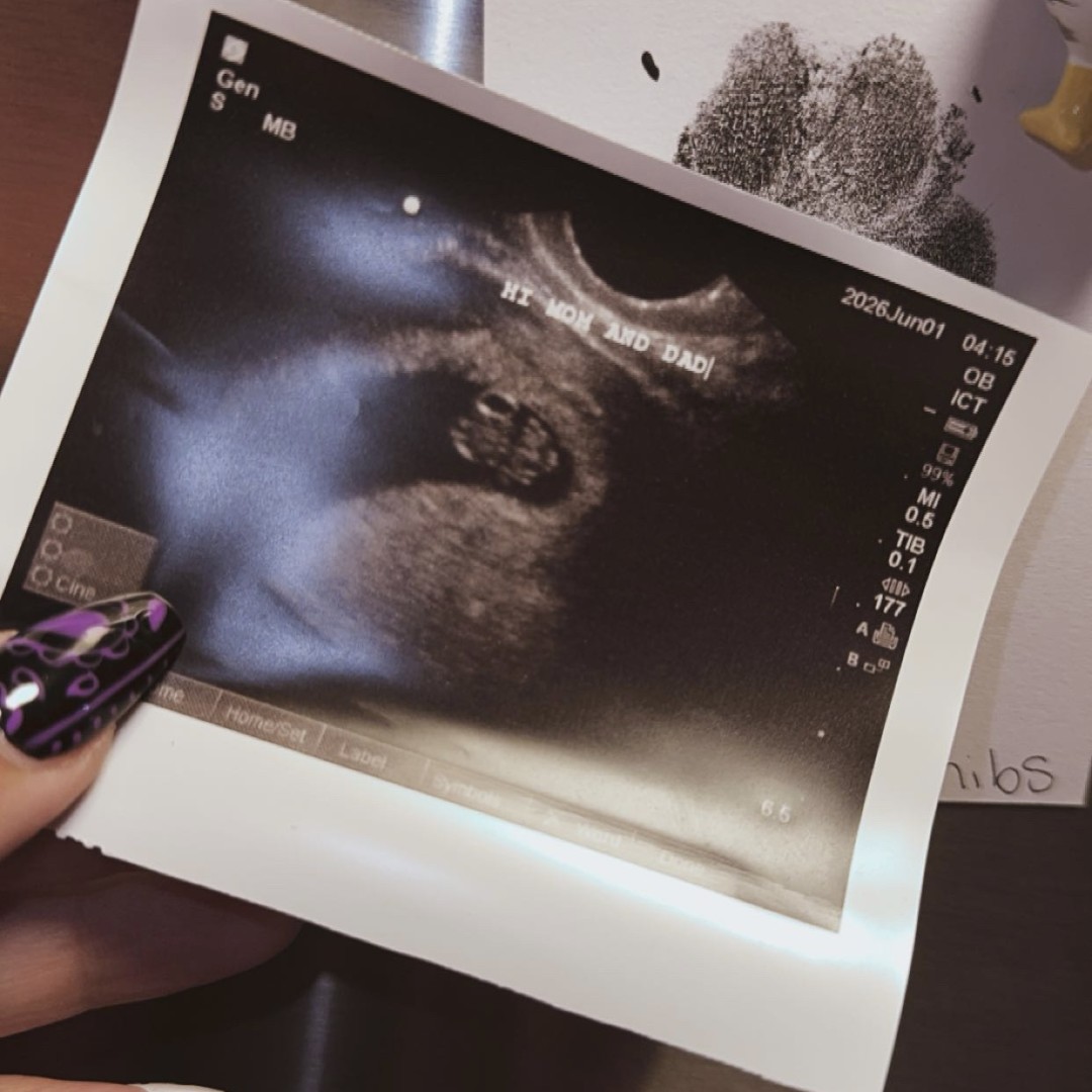Photo shared by Tayler for their Babylist baby registry.