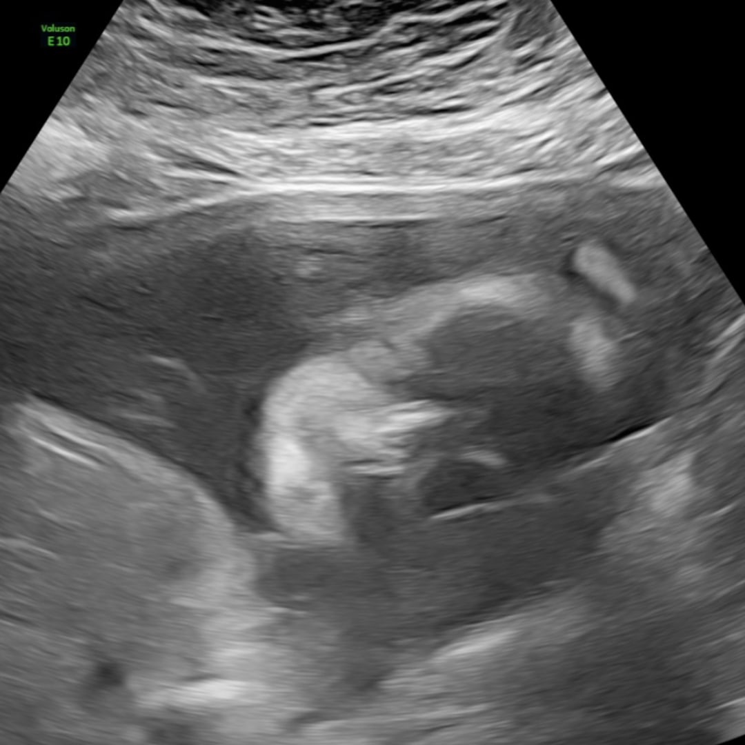 Photo shared by Kassandra for their Babylist baby registry.