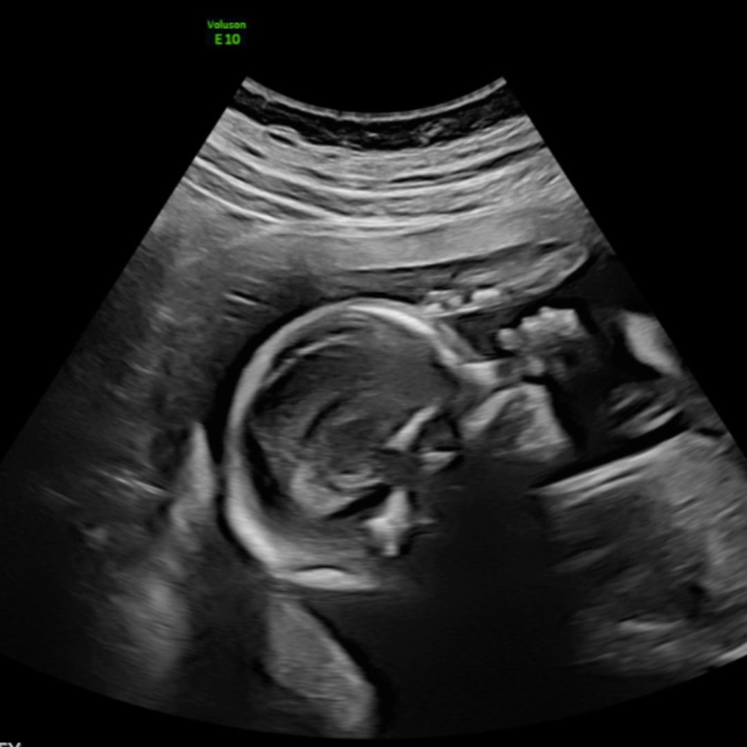 Photo shared by Anna for their Babylist baby registry.