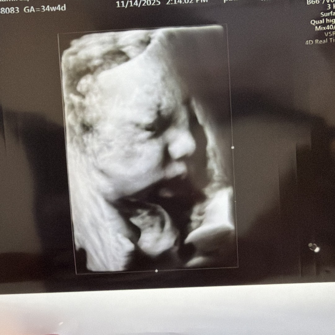 Photo shared by Jovanna for their Babylist baby registry.