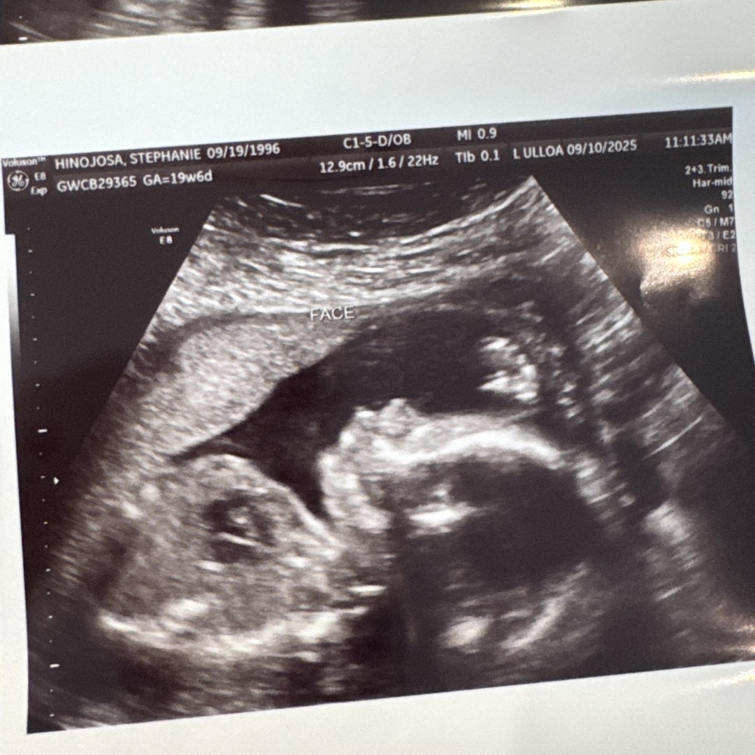 Photo shared by Stephanie for their Babylist baby registry.