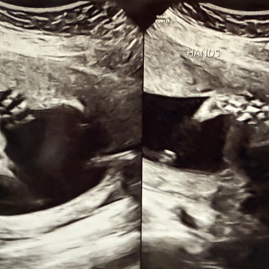 Photo shared by Andrew Freeman for their Babylist baby registry.