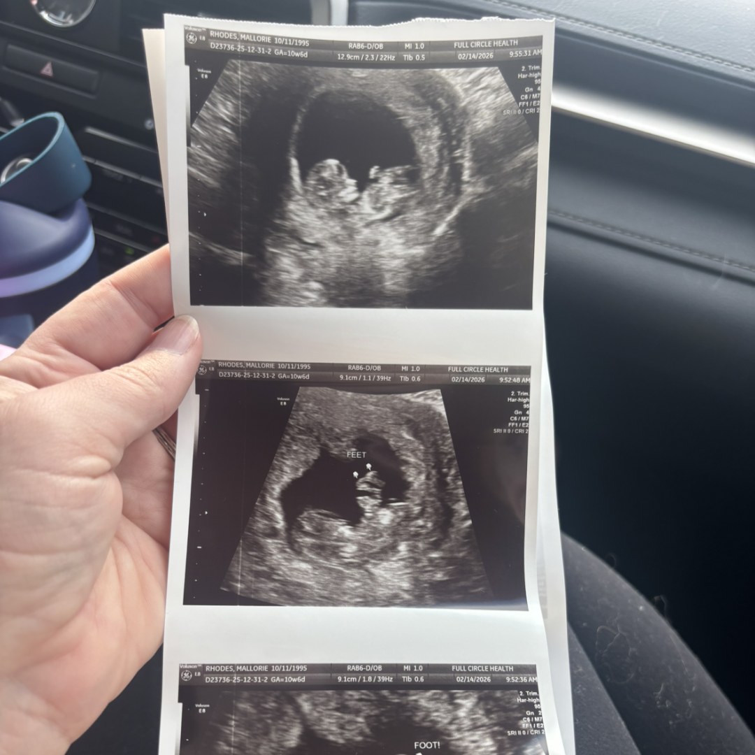 Photo shared by Mallorie for their Babylist baby registry.