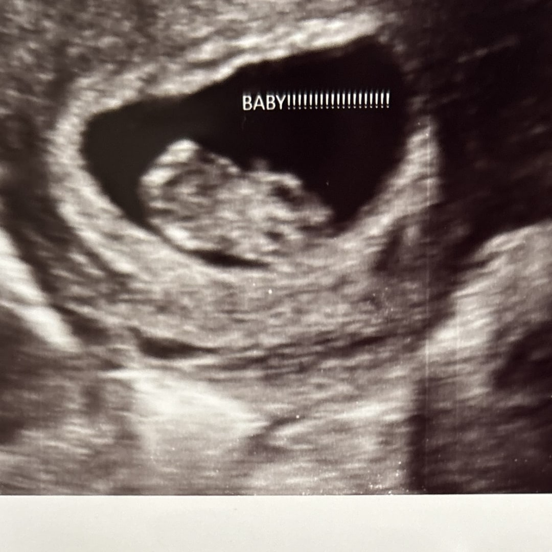 Photo shared by Jennifer for their Babylist baby registry.