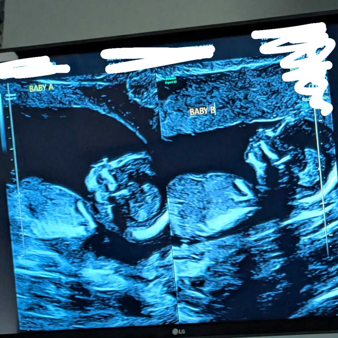 Photo shared by Jordan for their Babylist baby registry.