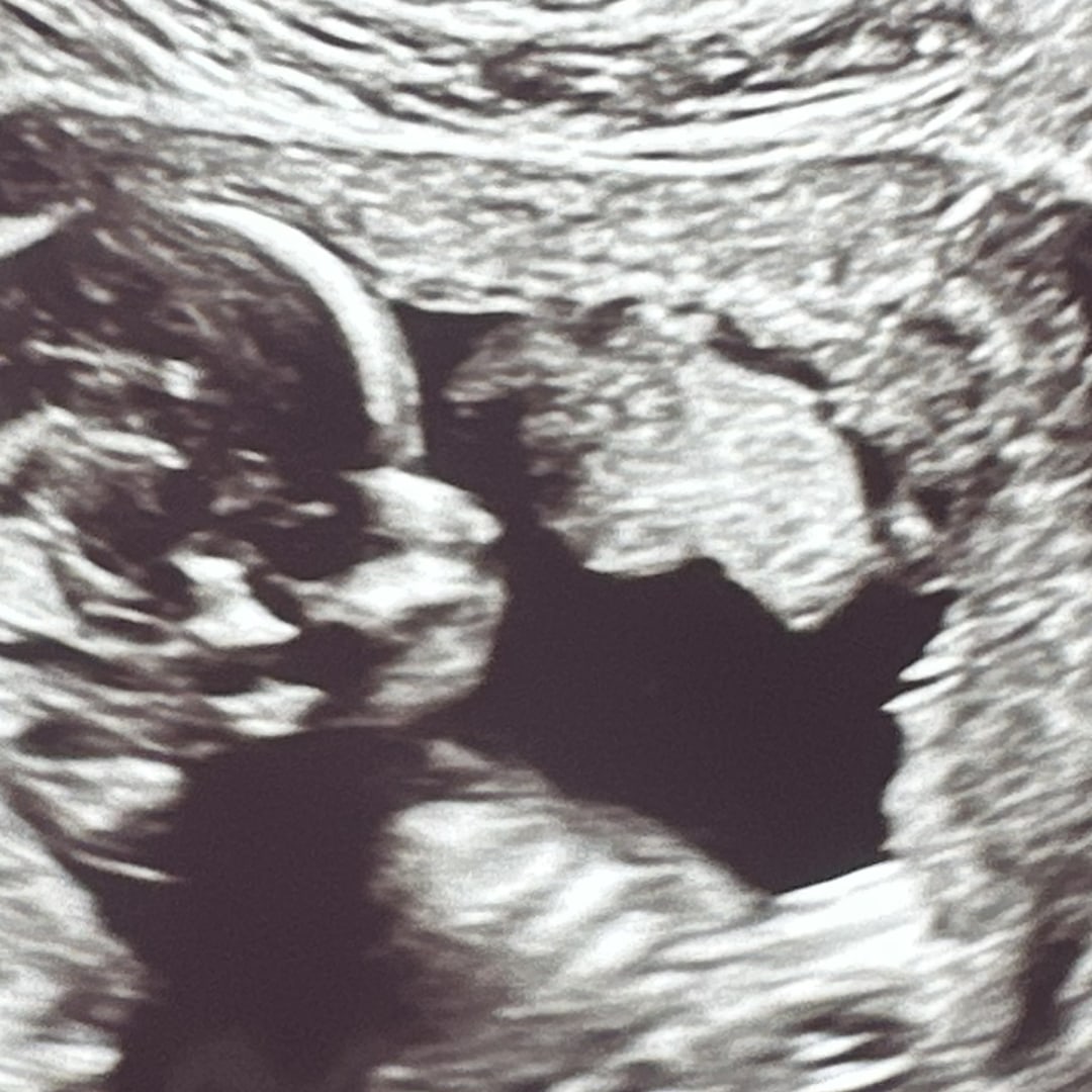 Photo shared by Cierra for their Babylist baby registry.