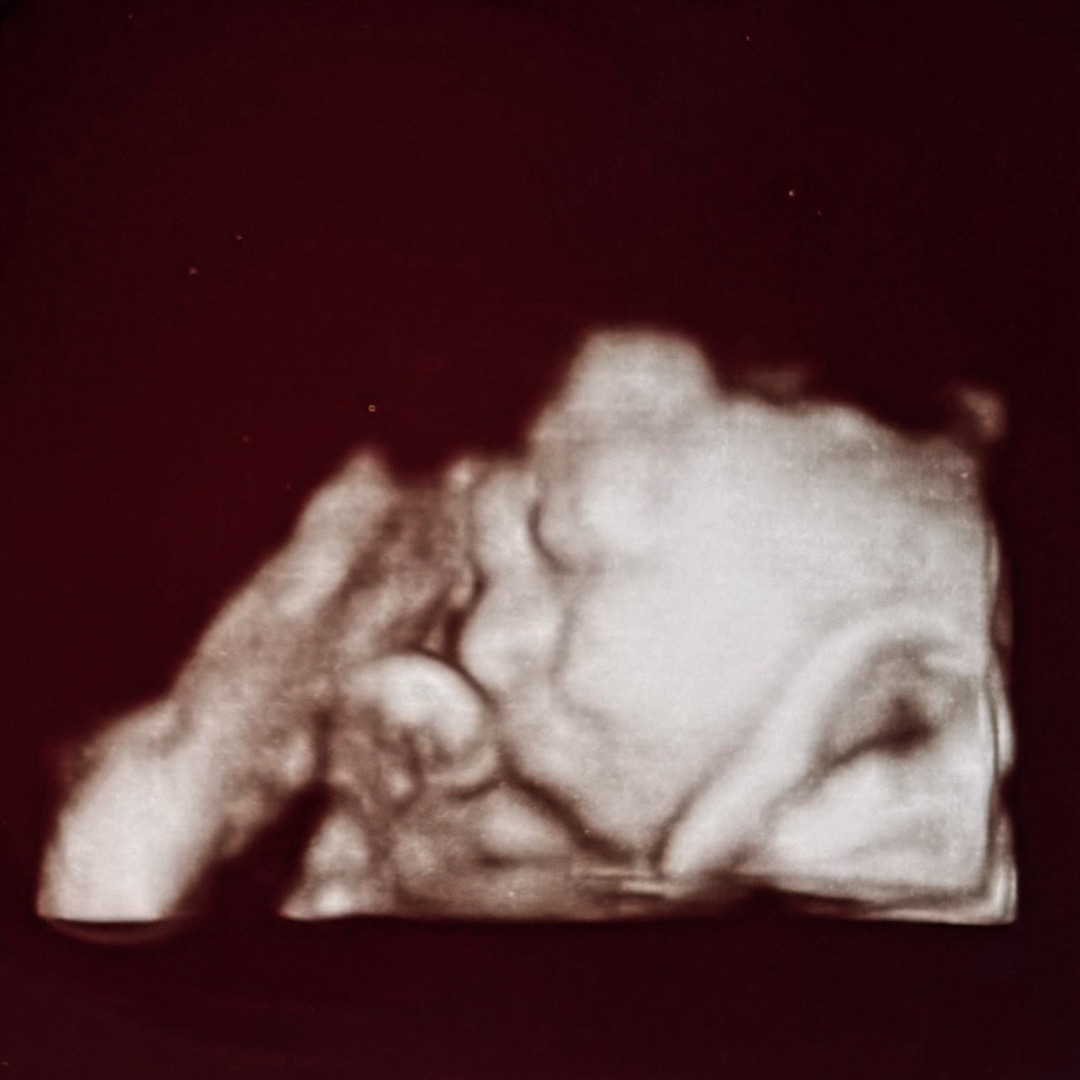 Photo shared by Davihanna for their Babylist baby registry.