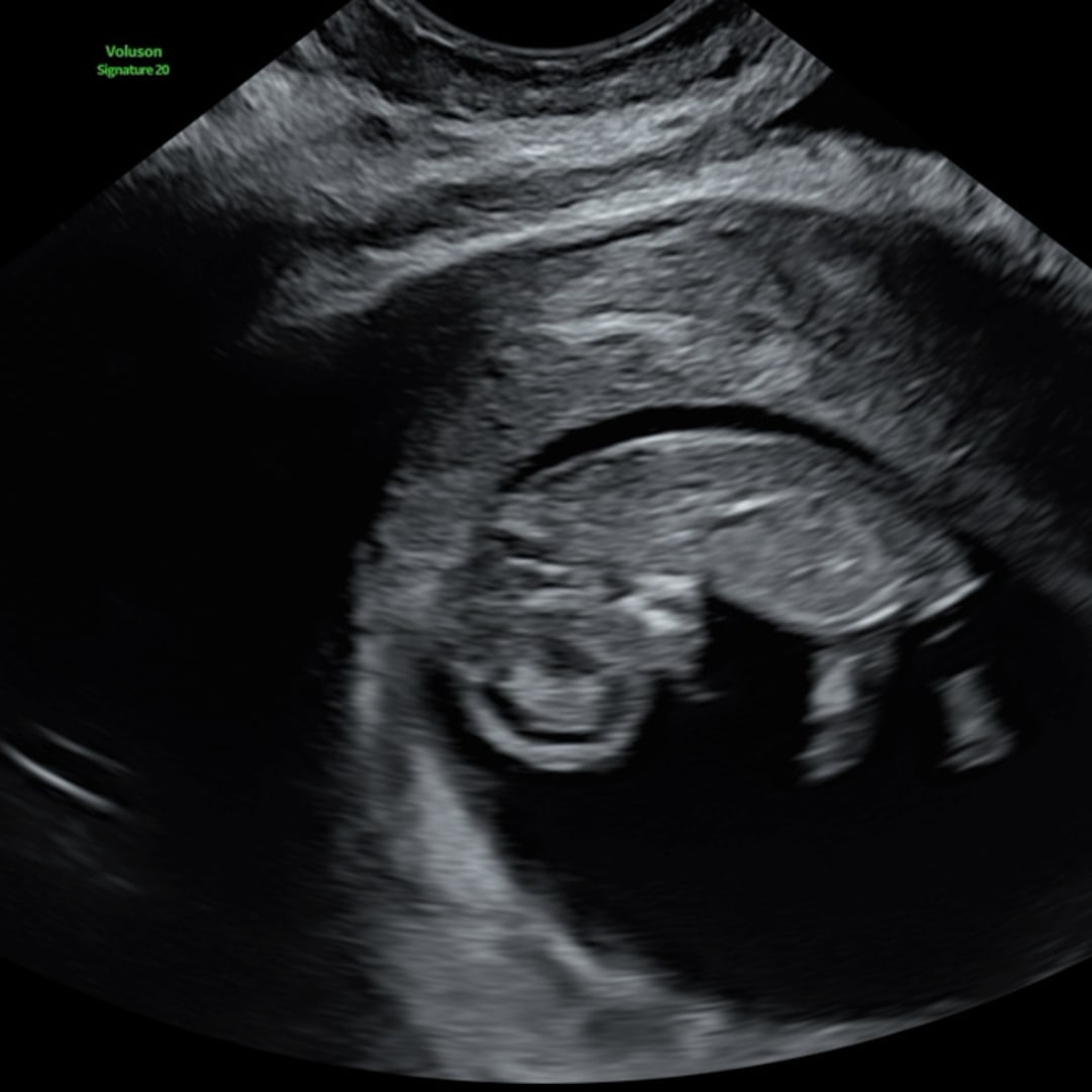 Photo shared by Drea for their Babylist baby registry.