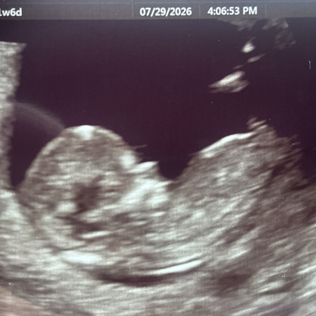 Photo shared by Jamie for their Babylist baby registry.