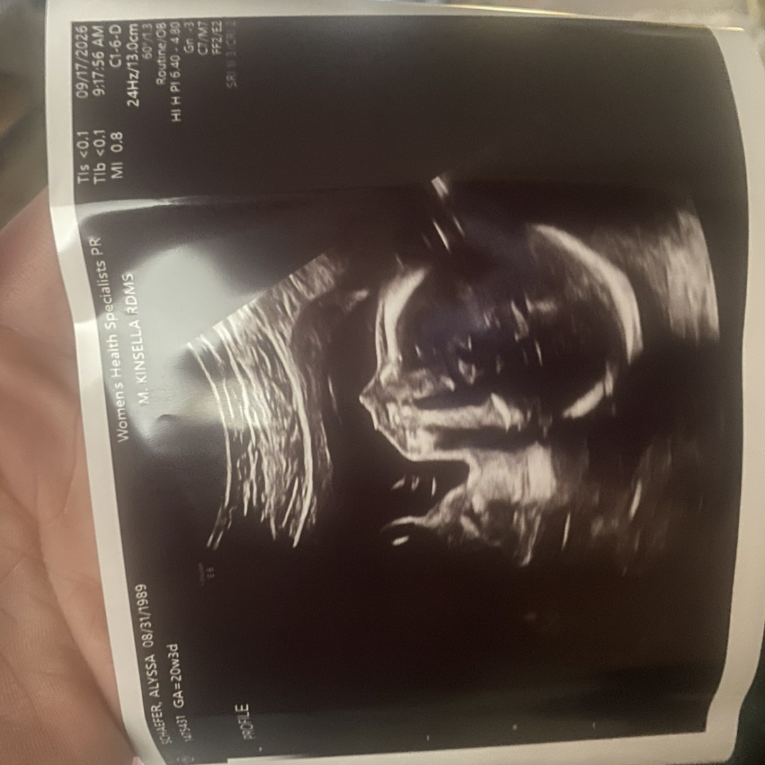 Photo shared by Alyssa for their Babylist baby registry.