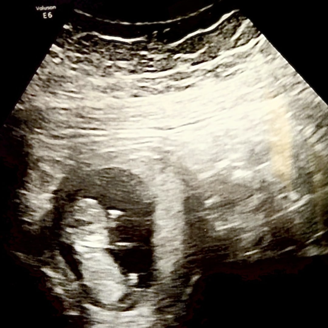 Photo shared by Leah for their Babylist baby registry.