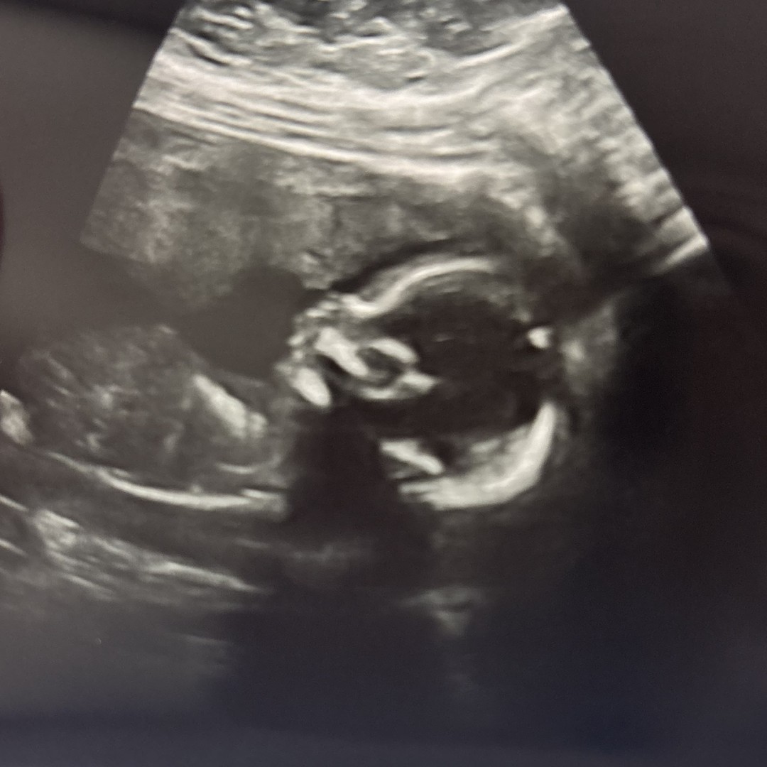 Photo shared by Alyssa for their Babylist baby registry.