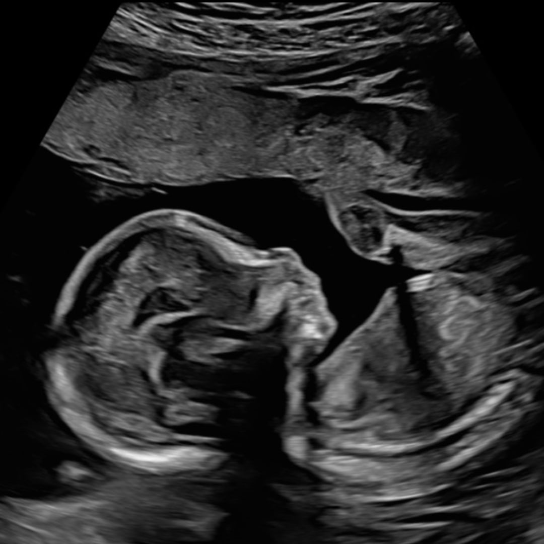Photo shared by Eryn for their Babylist baby registry.