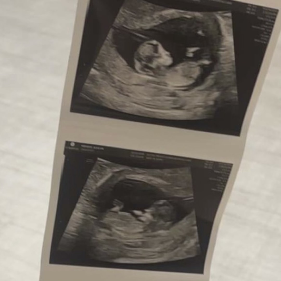 Photo shared by Ashlyn for their Babylist baby registry.