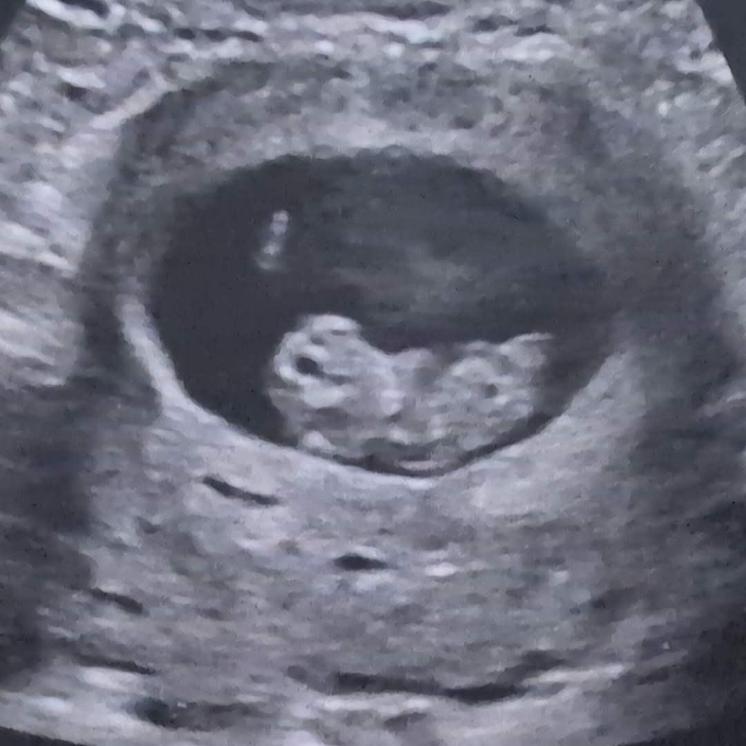 Photo shared by Samantha for their Babylist baby registry.