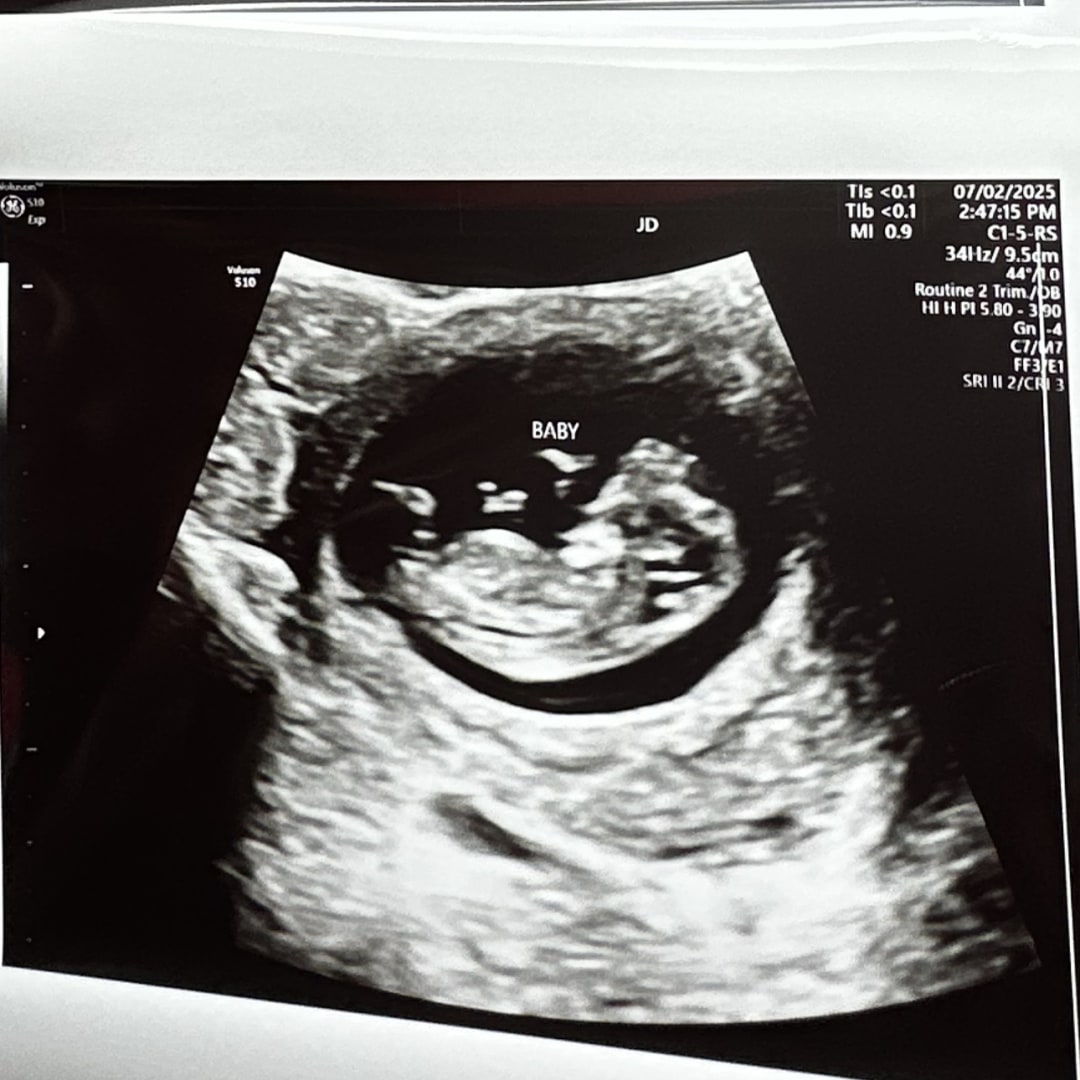 Photo shared by Erika for their Babylist baby registry.