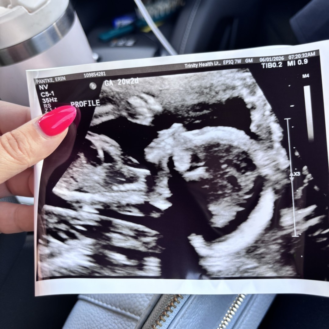 Photo shared by Erin for their Babylist baby registry.