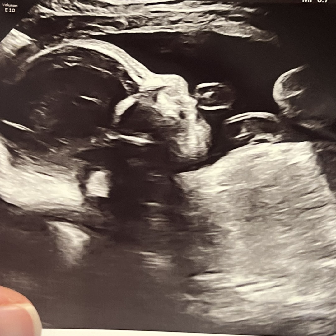 Photo shared by Jessica for their Babylist baby registry.