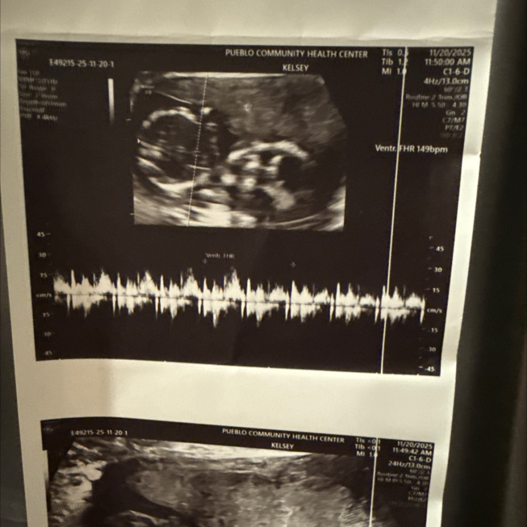 Photo shared by Angelina for their Babylist baby registry.