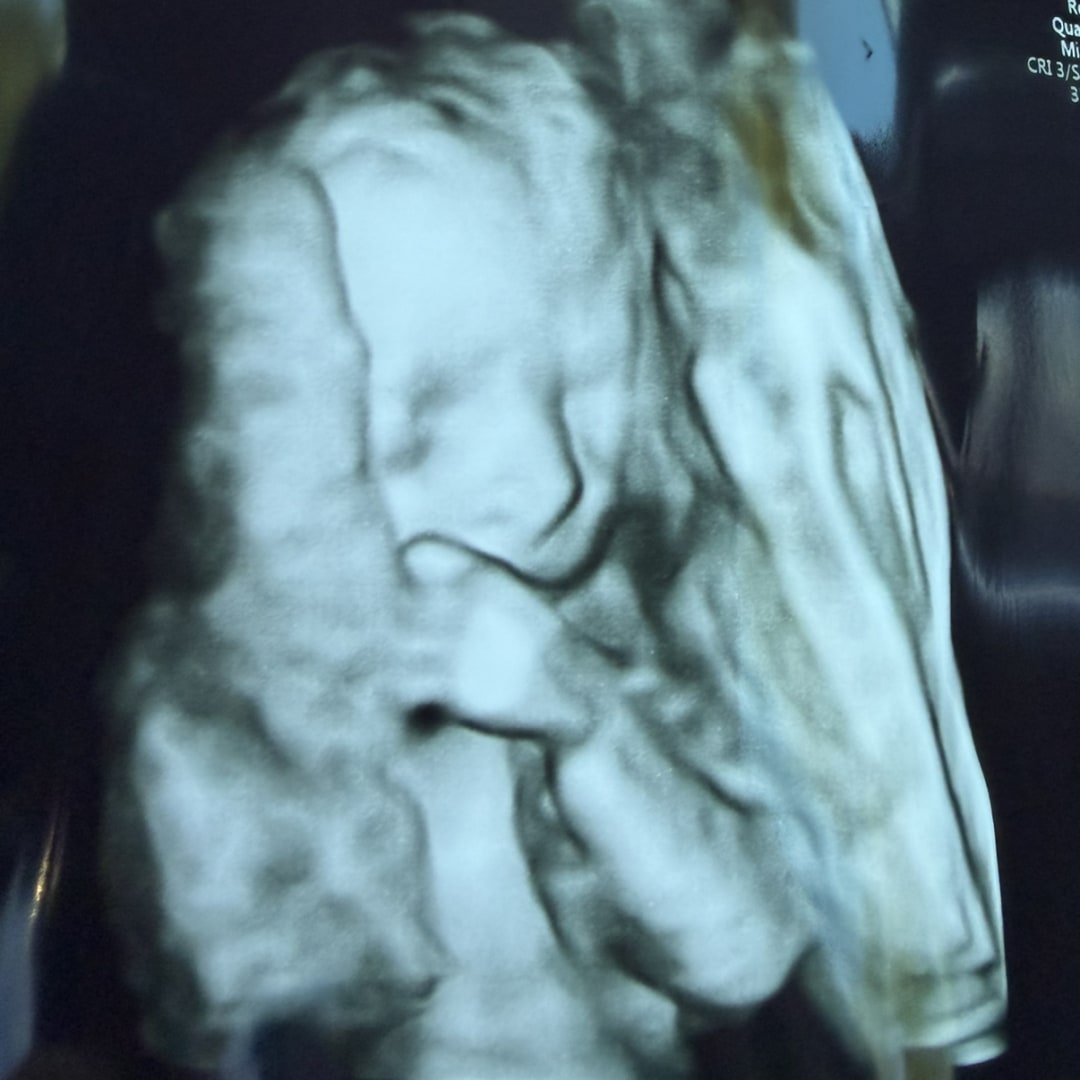 Photo shared by Ashley for their Babylist baby registry.