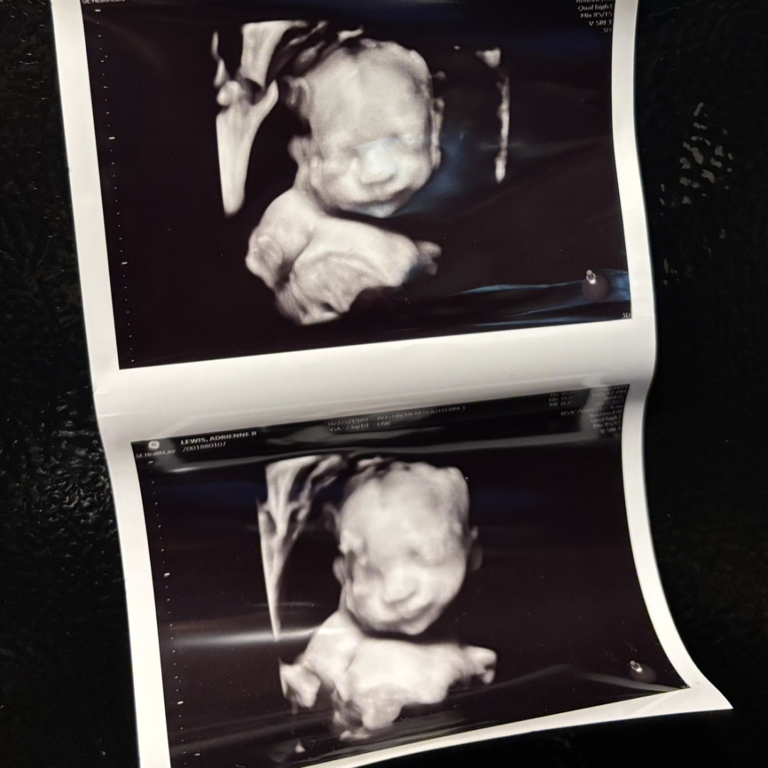 Photo shared by Adrienne for their Babylist baby registry.