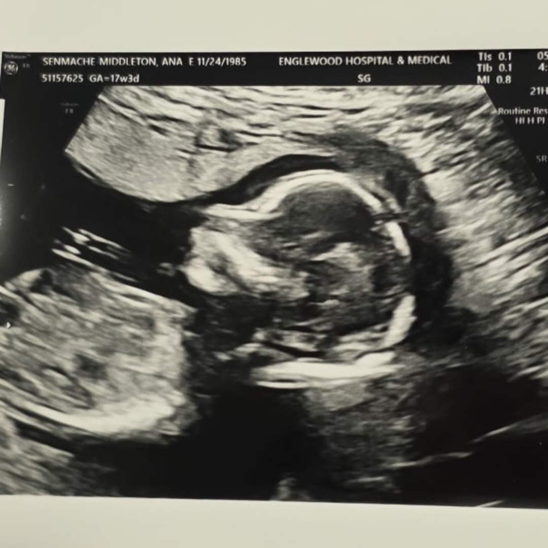 Photo shared by Elizabeth for their Babylist baby registry.