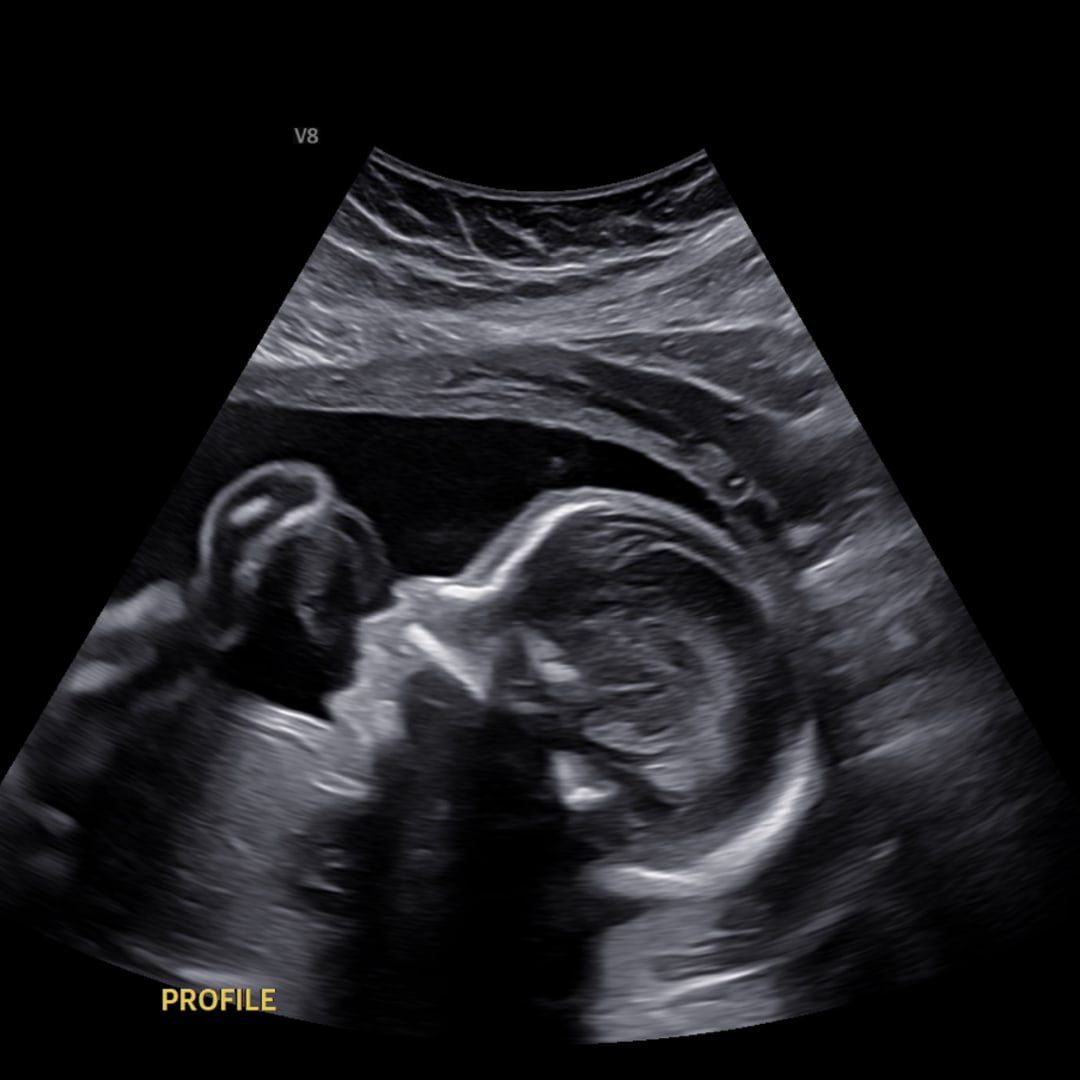 Photo shared by Charlize for their Babylist baby registry.
