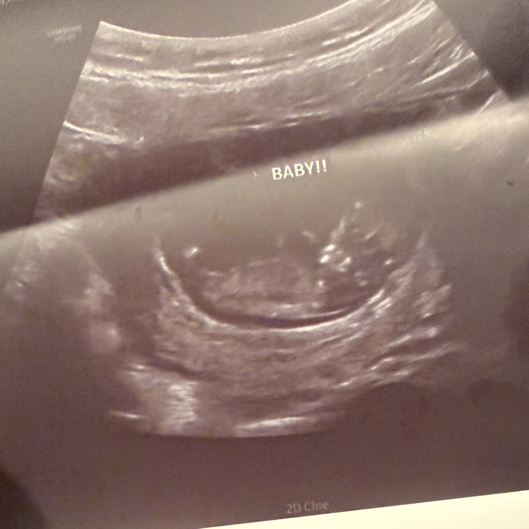 Photo shared by Elisabeth for their Babylist baby registry.