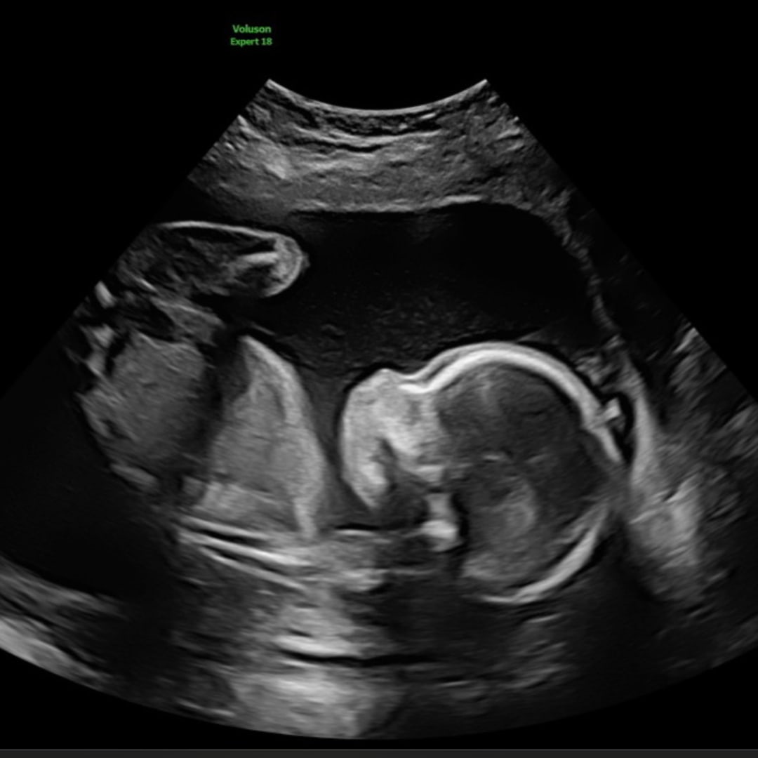 Photo shared by Brianna for their Babylist baby registry.